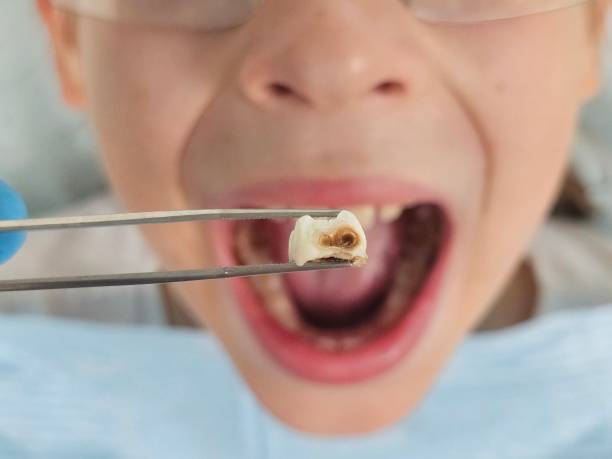 Best Emergency Cosmetic Dentistry (e.g., broken veneers) in Erin, TN